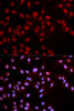 Cell Biology Antibodies 16 Anti-Phospho-MET-Y1349 Antibody CABP0077