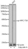 Epigenetics and Nuclear Signaling Antibodies 4 Anti-Phospho-MYC-T58 Antibody CABP0080