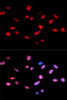 Cell Cycle Antibodies 2 Anti-Phospho-Rb-S811 Antibody CABP0089