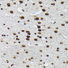 Epigenetics and Nuclear Signaling Antibodies 4 Anti-Phospho-JUN-S73 Antibody CABP0119