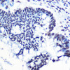 Immunology Antibodies 3 Anti-Phospho-RELA-S276 Antibody CABP0123