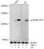Cell Death Antibodies 2 Anti-Phospho-NFKB1-S337 Antibody CABP0125