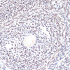 Cell Death Antibodies 2 Anti-Phospho-AKT1-S473 Antibody CABP0140