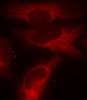 Cell Biology Antibodies 16 Anti-Phospho-YWHAZ-S58 Antibody CABP0195