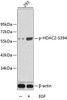 Cell Biology Antibodies 16 Anti-Phospho-HDAC2-S394 Antibody CABP0201