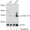 Developmental Biology Anti-Phospho-Stathmin-S16 Antibody CABP0229