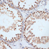 Cell Cycle Antibodies 2 Anti-Phospho-BRCA1-S1423 Antibody CABP0232