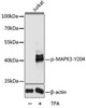 Cell Death Antibodies 2 Anti-Phospho-MAPK3-Y204 Antibody CABP0235