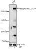 Metabolism Antibodies 3 Anti-Phospho-ACACA-S79 Antibody CABP0298