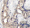 Cell Death Antibodies 2 Anti-Phospho-ABL1-Y412 Antibody CABP0303