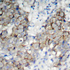 Cell Biology Antibodies 16 Anti-Phospho-IGF1R-Y1161 Antibody CABP0367