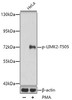 Cell Biology Antibodies 16 Anti-Phospho-LIM domain kinase 2-T505 Antibody CABP0388