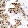 Cell Death Antibodies 2 Anti-Phospho-NFKB1-S893 Antibody CABP0415