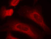 Immunology Antibodies 3 Anti-Phospho-STAT1-S727 Antibody CABP0453