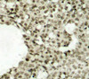 Immunology Antibodies 3 Anti-Phospho-STAT1-S727 Antibody CABP0453