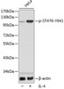 Epigenetics and Nuclear Signaling Antibodies 4 Anti-Phospho-STAT6-Y641 Antibody CABP0456