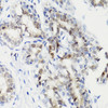 Immunology Antibodies 3 Anti-Phospho-Stat3-S727 Antibody CABP0474