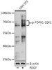 Epigenetics and Nuclear Signaling Antibodies 4 Anti-Phospho-PDK1-S241 Antibody CABP0477