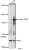 Cell Biology Antibodies 16 Anti-Phospho-CHUK-S176 Antibody CABP0505