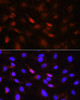 Cell Biology Antibodies 16 Anti-Phospho-Jak1-Y1022/1023 Antibody CABP0530