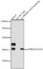 Cell Biology Antibodies 16 Anti-Phospho-PRKACA-S339 Antibody CABP0558