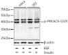 Cell Biology Antibodies 16 Anti-Phospho-PRKACA-S339 Antibody CABP0558