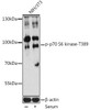 Cell Death Antibodies 2 Anti-Phospho-P70S6K1-T389 Antibody CABP0564