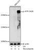 Epigenetics and Nuclear Signaling Antibodies 4 Anti-Phospho-ATR-S428 Antibody CABP0676