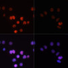 Immunology Antibodies 3 Anti-Phospho-POLR2A-S2 pAb Antibody CABP0749