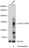 Immunology Antibodies 3 Anti-Phospho-Jak2-Y1008 pAb Antibody CABP0772