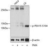 Cell Death Antibodies 2 Anti-Phospho-PEA15-S104 pAb Antibody CABP0788