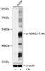 Cell Biology Antibodies 16 Anti-Phospho-NDRG1-T346 pAb Antibody CABP0792