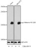 Epigenetics and Nuclear Signaling Antibodies 4 Anti-Phospho-Histone H3-S28 pAb Antibody CABP0839