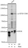 Cell Biology Antibodies 16 Anti-Phospho-EEF2K-S366 pAb Antibody CABP0845