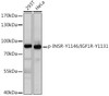 Cell Biology Antibodies 16 Anti-Phospho-INSR-Y1146/IGF1R-Y1131 pAb Antibody CABP0863