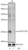 Cell Biology Antibodies 16 Anti-Phospho-MYL9-S19 pAb Antibody CABP0872