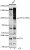 Metabolism Antibodies 3 Anti-Phospho-GYS1-S641 pAb Antibody CABP0877