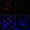 Protein Tags Anti-Mouse anti HA-Tag Monoclonal Antibody CABE008