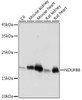 Metabolism Antibodies 3 Anti-NDUFB8 Monoclonal Antibody CAB19732