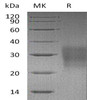 Mouse FAS/TNFRSF6 Recombinant Protein (His Tag) (Active) (RPES0092)