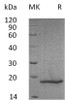 Mouse COL18A1/Endostatin Recombinant Protein (RPES0100)