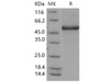 Mouse CD302/CLEC13A Recombinant Protein (Fc Tag) (RPES0113)