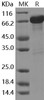 Human GAD65/GAD2/GAD-2 Recombinant Protein (GST Tag) (RPES0129)