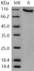 Human GRK2/ADRBK1 Recombinant Protein (His & GST Tag) (RPES0131)