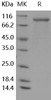 Human G-CSFR/CD114 Recombinant Protein (His Tag) (Active) (RPES0132)