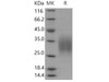 Mouse CD83/HB15 Recombinant Protein (aa 133, His Tag) (RPES0156)