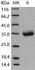 Mouse CXADR/CAR Recombinant Protein (His Tag) (Active) (RPES0157)
