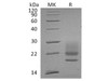 Human CD83/HB15 Recombinant Protein (RPES0159)
