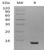 Mouse Complement C5 Recombinant Protein (RPES0164)