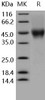 Human CD16a/FCGR3A Recombinant Protein (RPES0171)